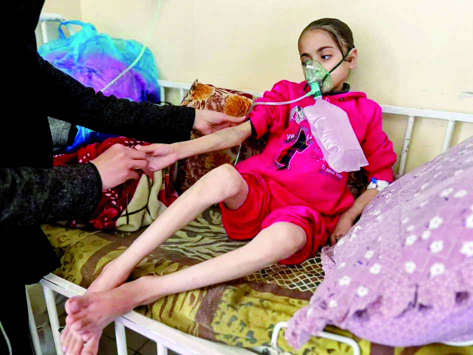 اليونيسف: أكثر من 10 آلاف طفل في غزة بحاجة عاجلة لعلاج من سوء التغذية الحاد